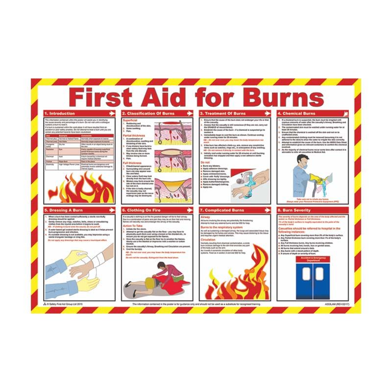 Sign Workplace Safety Chart - First Aid For Burns 590x420
